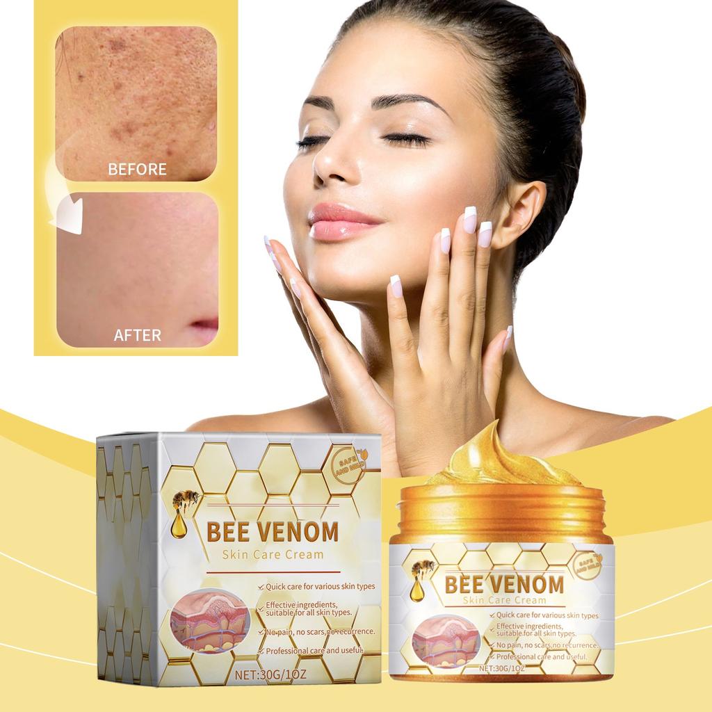Bee Venom skincare cream packaging with a woman applying cream and skin before/after comparison on a yellow background. HOUKEA - Bee Venom Skin Care Cream