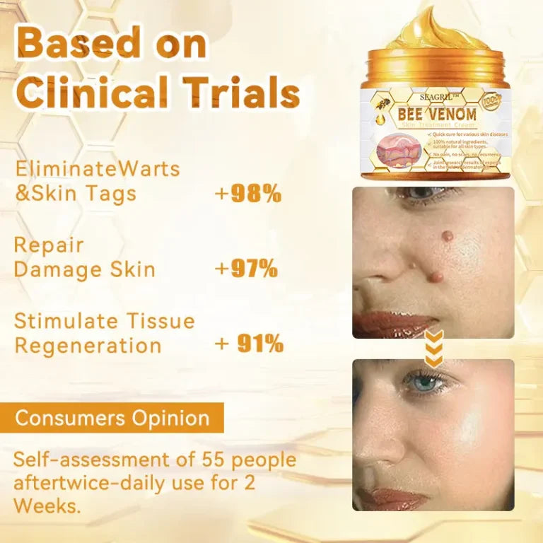 Advertisement for a skin care product with clinical trial results and consumer opinions. HOUKEA - Bee Venom Skin Care Cream