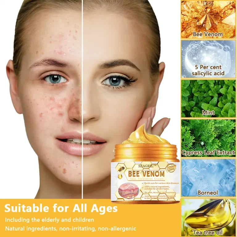Skincare product with ingredients and before-and-after effects on skin HOUKEA - Bee Venom Skin Care Cream