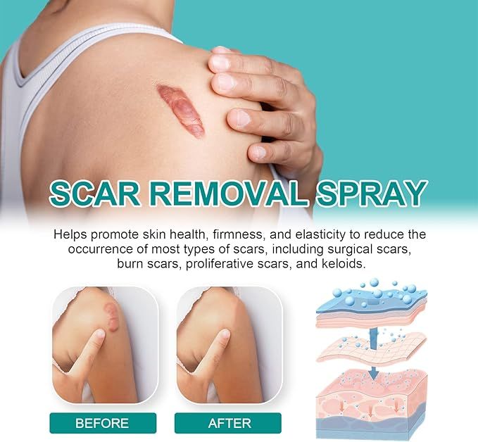 Advertisement for scar removal spray showing before and after effects on skins health 
